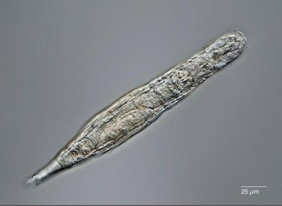 ​人类长生有望？2.4万年前的微生物解冻后复活，生命极限在哪里？