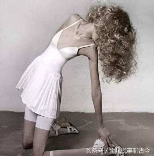 她是世界上最瘦女孩 体重只有22斤 还在坚持做减肥操!你羡慕么?