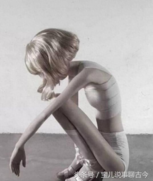 她是世界上最瘦女孩 体重只有22斤 还在坚持做减肥操!你羡慕么?