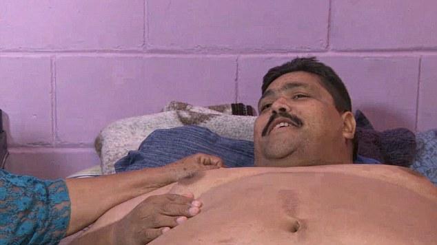 世界上最胖的人，体重870斤