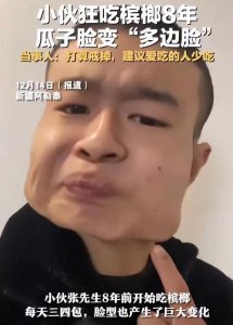河南小伙嚼槟榔8年成方脸:已经吃了40多万,网友:还以为是特效