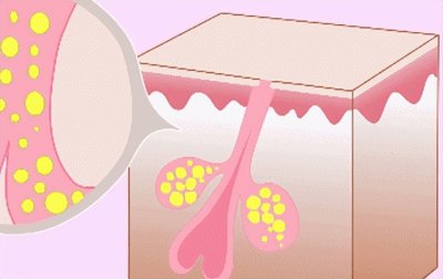 毛孔怎么变小 4种方法,分分钟让毛孔缩小,简单有效