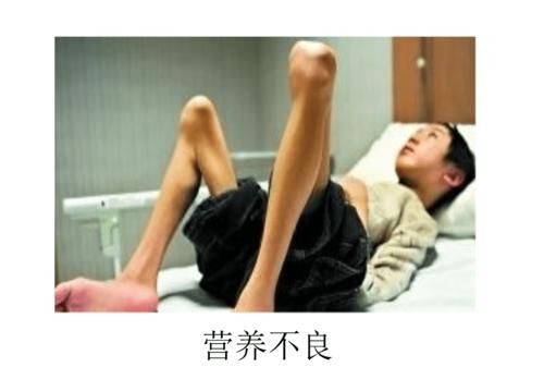 营养不良和营养过剩的区别